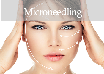 Microneedling