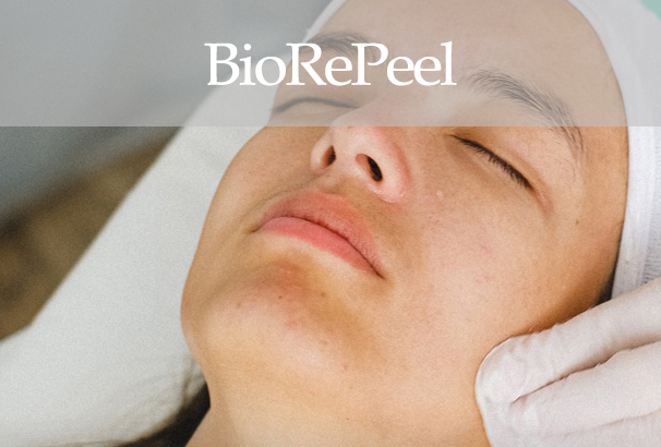 biorepeel